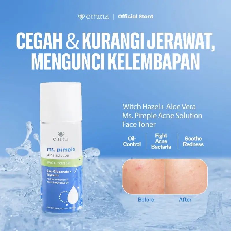 EMINA MS.PIMPLE ACNE 100ML ACNE SOLUTION FACE TONER